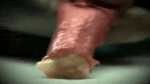 Artery.mp4