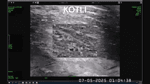 Sidhant Sibal - Watch： India strikes Pakistani terror camps in Kotli. Strikes .mp4
